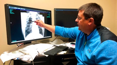 In this Jan. 24, 2019 file photo Dr. Brandon Crum points to the X-ray of a black lung patient at his office in Pikeville, Ky. A report released Tuesday, Dec. 10 by the Washington-based group Taxpayers for Common Sense says a cut to the tax that coal companies pay to fund the Black Lung Disability Trust Fund, a trust for sick miners, will cost taxpayers billions of dollars.