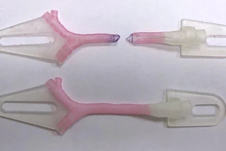 3D-printed models showing virtual surgical planning for a slide tracheoplasty procedure, courtesy Kaalan Johnson, M.D., Seattle Children's Hospital.