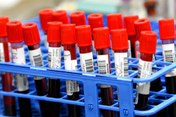 Blood samples from volunteers participating in the last-stage testing of the COVID-19 vaccine by Moderna and the National Institutes.