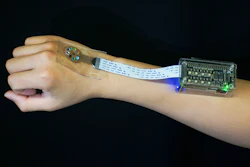 A unique 3D-printed light-sensing medical device could help millions of people worldwide with lupus and other light-sensitive diseases by providing access to real-time data for more personalized treatments.