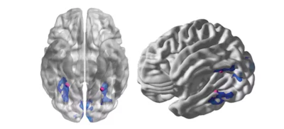 Brain scans could provide information that descriptions of personal experience can’t. This image shows activity in the areas of the brain specializing in processing visual objects. Signals from these brain regions could provide measures of visual similarity less susceptible to biases in self-reports.