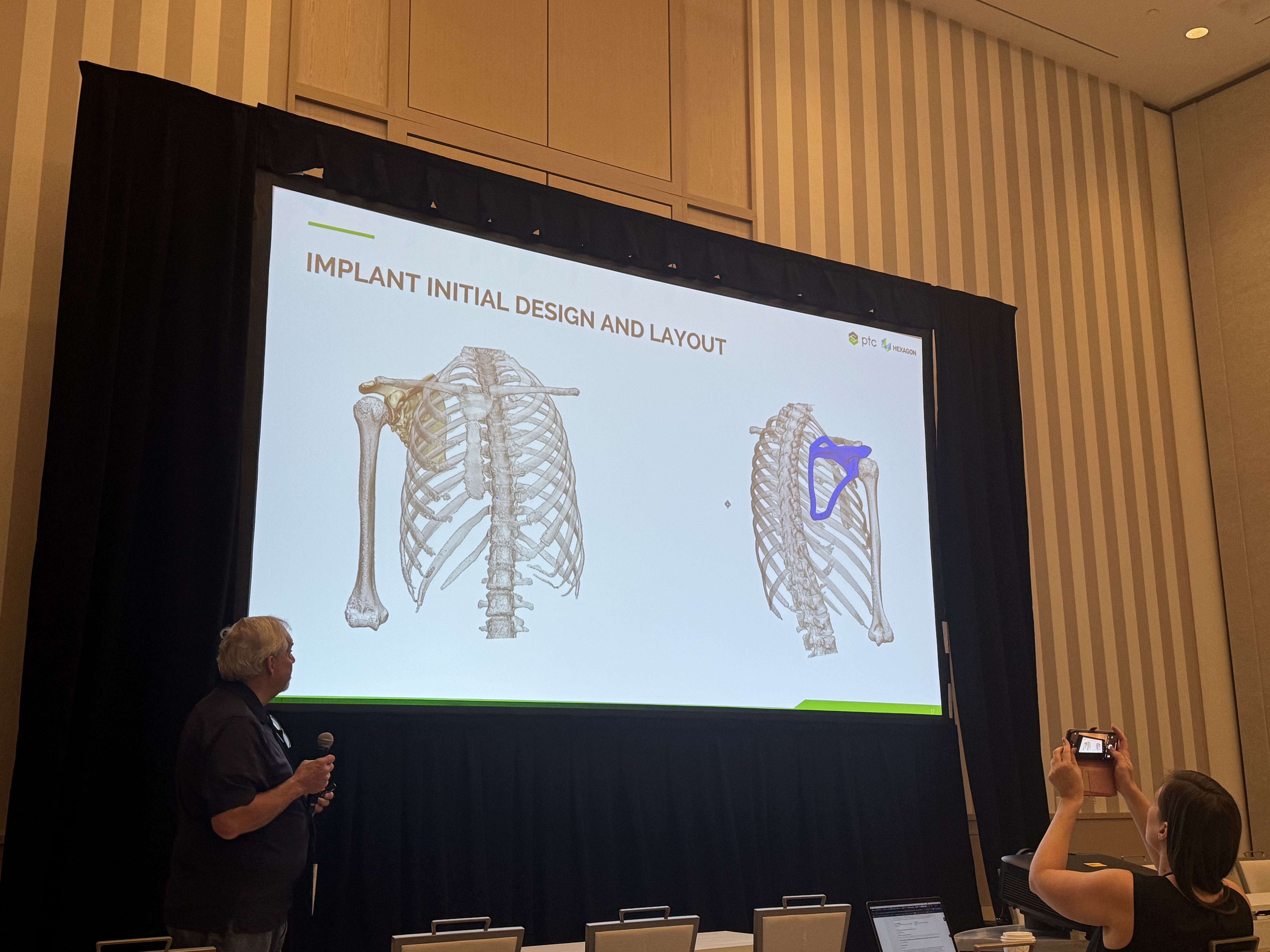 Goodwin shows the layout of the scapula implant's design.